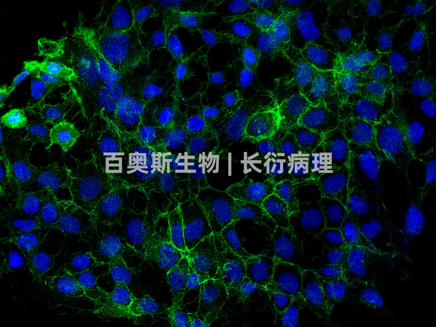 E-cadherin(green)---细胞-300倍---86底板.jpg