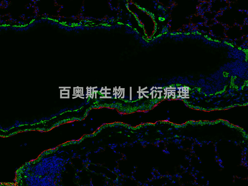 α-SMA(green)+CD31(red)---小鼠-肺-200倍---86底板.jpg