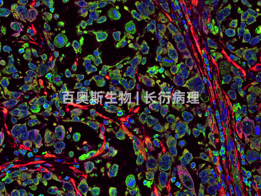 GFP(green)+α-SMA(red)+CK20(pink)---小鼠-肿瘤-400倍---86底板.jpg