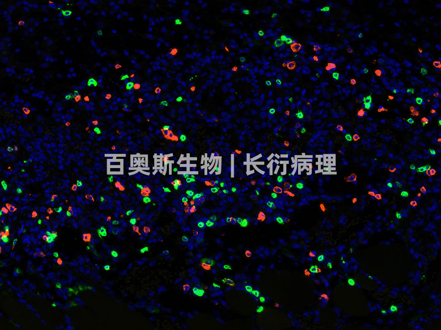 CD4(green)+CD8(orange)---小鼠-肿瘤-200倍---86底板.jpg