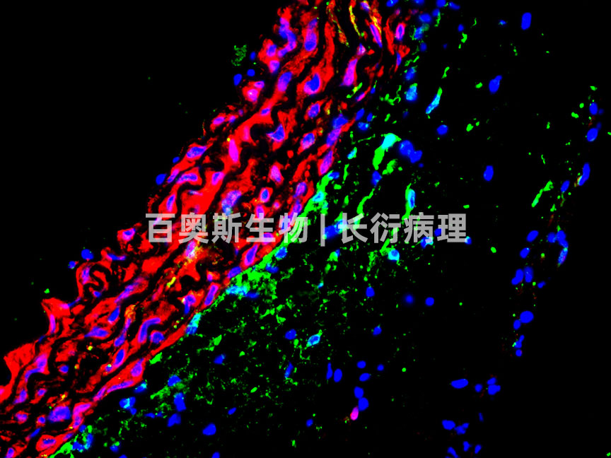 86-CD34(绿)+VEGFR2(红)小鼠血管.jpg