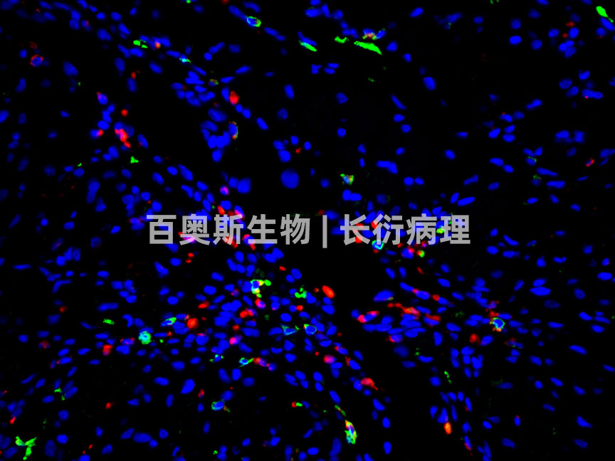 86-CD68(红)+CD163(绿)-小鼠心脏.jpg