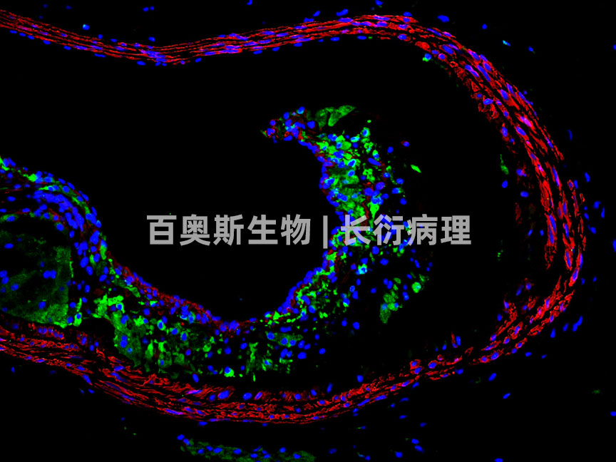 86-CD68(绿)+α-SMA(红)-小鼠血管.jpg