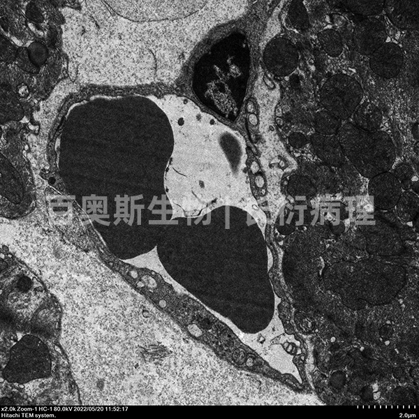 透射电镜 血管+血管内皮细胞.jpg
