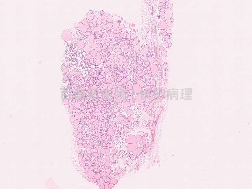 HE---甲状腺最大面---86底板.jpg