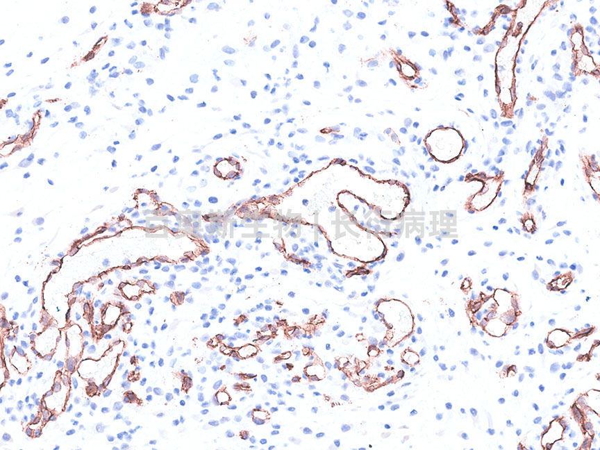 CD31---大鼠-皮下种植材料---86底板.jpg