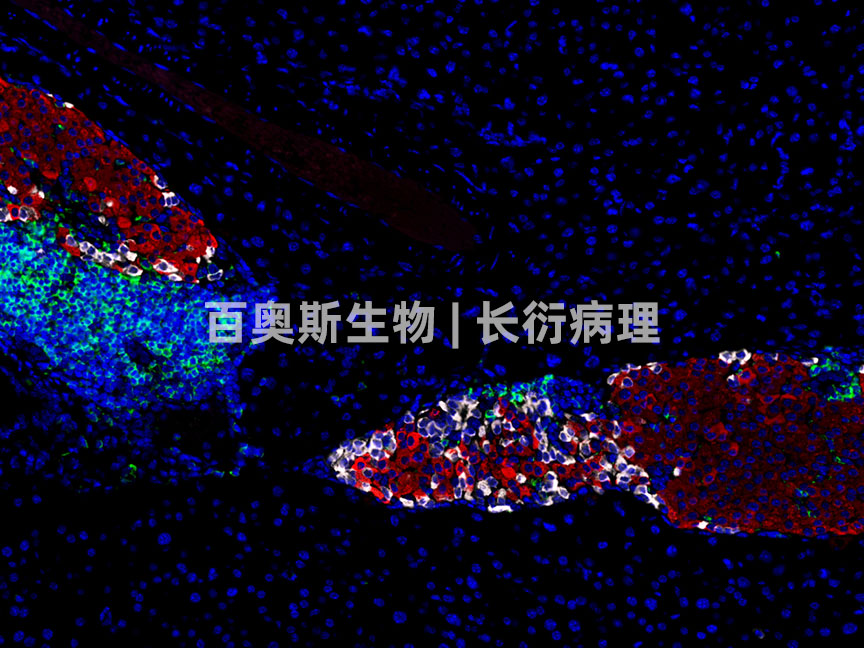 CD45(green)+Insulin(red)+Glucagon（white)---小鼠-胰腺-200倍---86底板.jpg