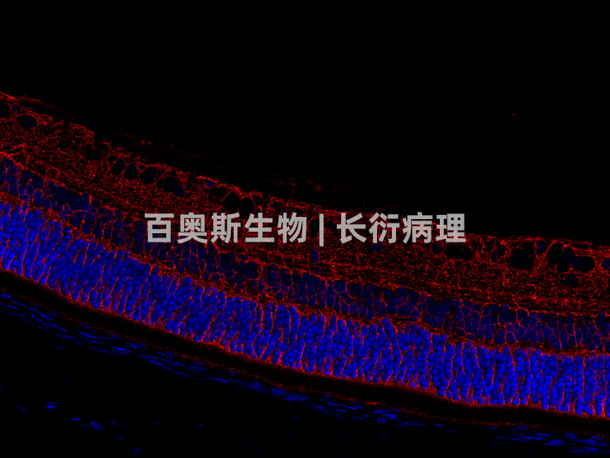 GLAST(red)---小鼠-眼球-300倍---86底板.jpg