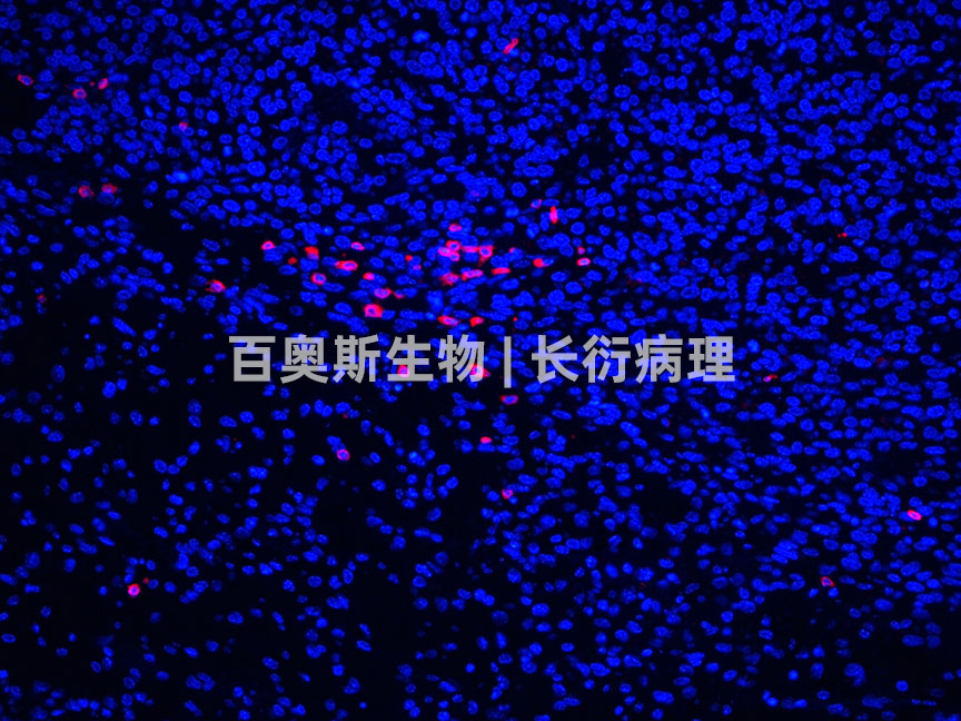 86-CD3-移植瘤.jpg