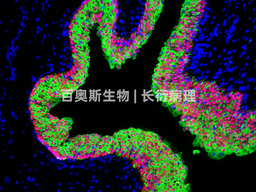 86-CK8(绿)+P63(红)-狗前列腺.jpg