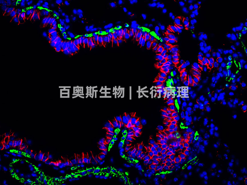 86-E-cad(红)+α-SMA(绿)-小鼠肺.jpg