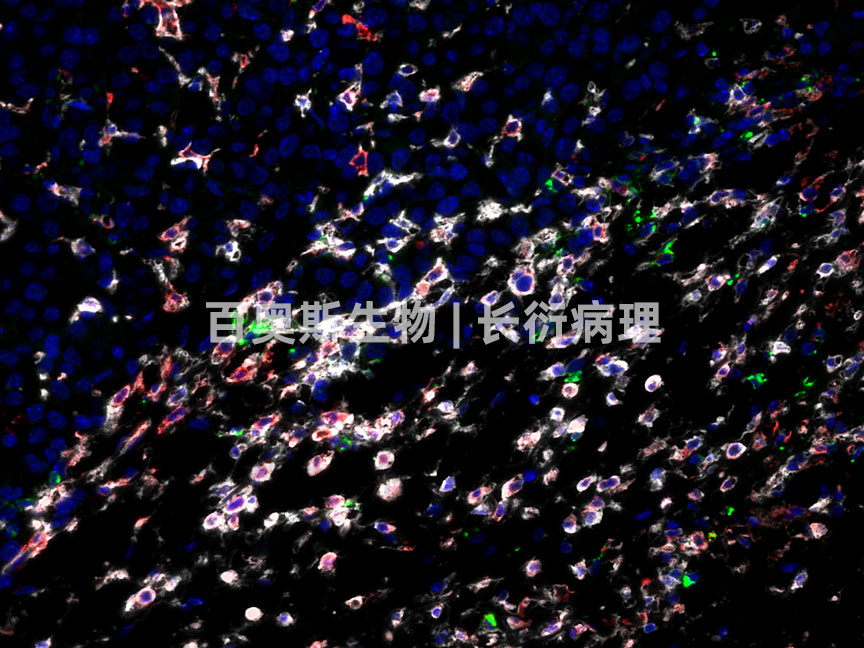 86-M-肿瘤-PD-L1-FITC+CD206-CY3+F480-CY5.jpg