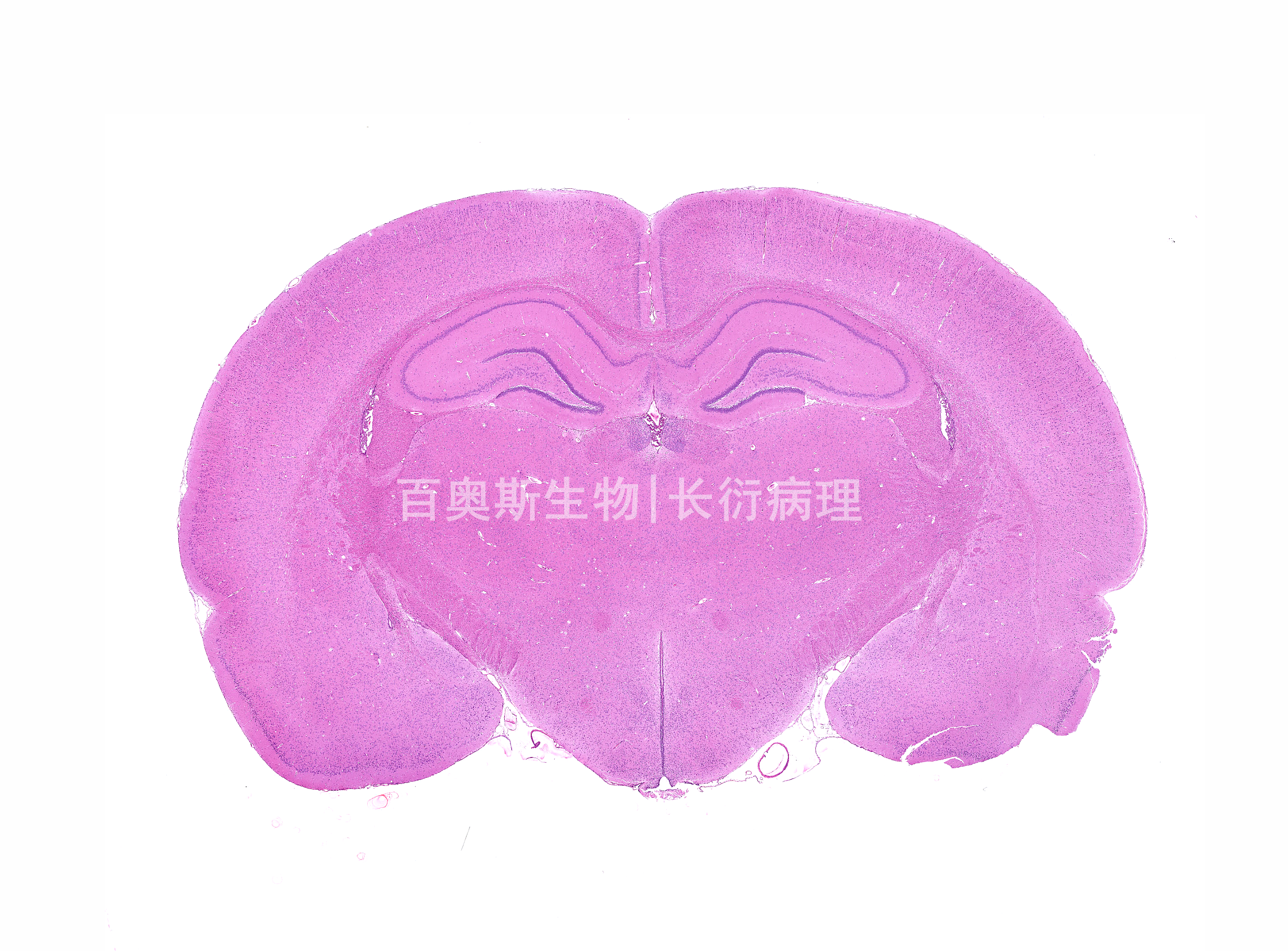 小鼠-脑HE染色_副本.png